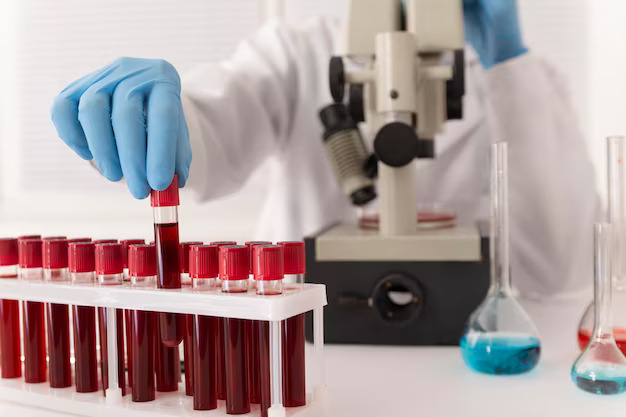 Blood Sample Testing