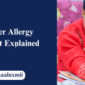 Pet Dander Allergy Treatment